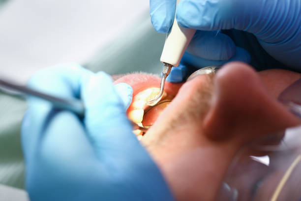 Best Affordable Emergency Dental Care  in New Burlington, OH