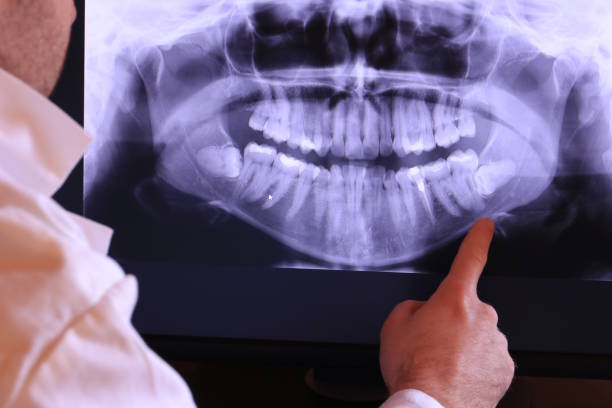 Best Tooth Infection Emergency Dentist  in New Burlington, OH