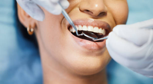 Best Walk-In Dentist Near Me  in New Burlington, OH