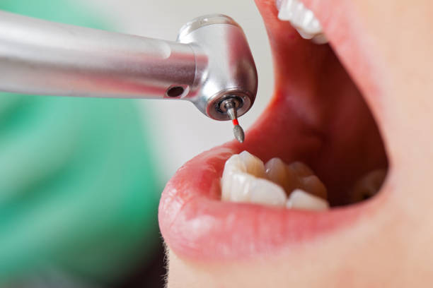 Best Knocked-Out Tooth Emergency  in New Burlington, OH